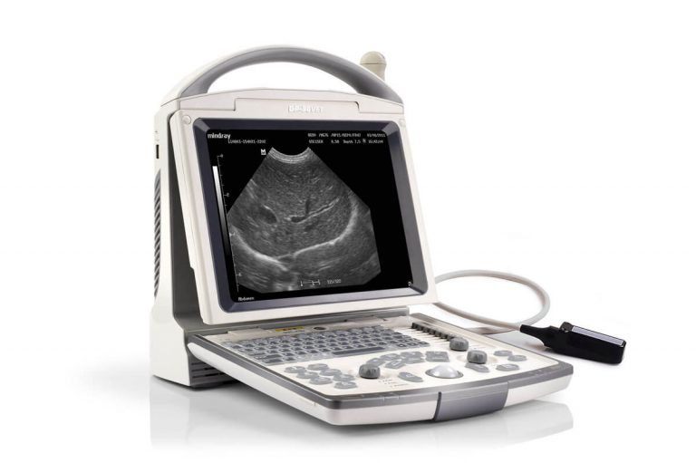 Mindray DP 30 - B/W Digital Ultrasonic Diagnostic Imaging System